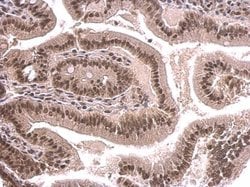 Invitrogen SNRPD2 Polyclonal Antibody 100 μL; Unconjugated:Antibodies,