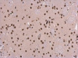 Invitrogen SNRPD2 Polyclonal Antibody 100 μL; Unconjugated:Antibodies,
