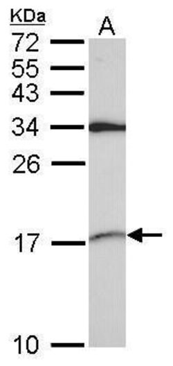 Invitrogen SNRPD2 Polyclonal Antibody 100 μL; Unconjugated:Antibodies,