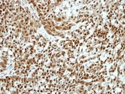 Invitrogen Ku70 Polyclonal Antibody 100 &mu;L; Unconjugated:Antibodies,