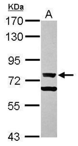 Invitrogen Ku70 Polyclonal Antibody 100 &mu;L; Unconjugated:Antibodies,
