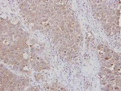 Invitrogen RPL3 Polyclonal Antibody 100 &mu;L; Unconjugated:Antibodies,