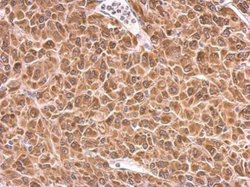 Invitrogen PRKCSH Polyclonal Antibody 100 &mu;L | Buy Online | Invitrogen&trade; | Fisher Scientific