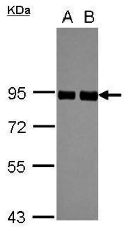 Invitrogen PRKCSH Polyclonal Antibody 100 &mu;L | Buy Online | Invitrogen&trade; | Fisher Scientific