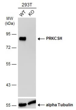 Invitrogen PRKCSH Polyclonal Antibody 100 &mu;L | Buy Online | Invitrogen&trade; | Fisher Scientific