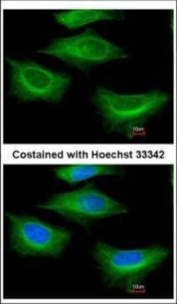 Invitrogen beta Tubulin 2 Polyclonal Antibody 100 &mu;L | Buy Online | Invitrogen&trade; | Fisher Scientific
