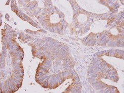 Invitrogen beta Tubulin 2 Polyclonal Antibody 100 &mu;L; Unconjugated:Antibodies,