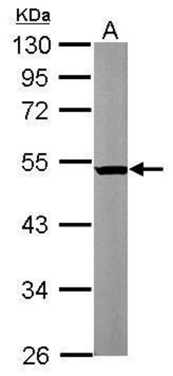Invitrogen beta Tubulin 2 Polyclonal Antibody 100 &mu;L; Unconjugated:Antibodies,