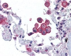 Invitrogen TRPV2 Polyclonal Antibody 100 &mu;L; Unconjugated:Antibodies,