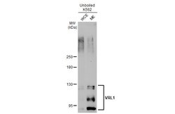 Invitrogen TRPV2 Polyclonal Antibody 100 &mu;L; Unconjugated:Antibodies,