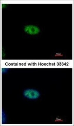 Invitrogen NYREN18 Polyclonal Antibody 100 &mu;L; Unconjugated:Antibodies,