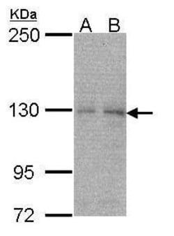 Invitrogen NYREN18 Polyclonal Antibody 100 &mu;L; Unconjugated:Antibodies,