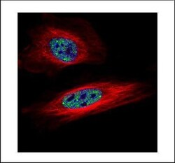 Invitrogen SNRPB Polyclonal Antibody 100 &mu;L; Unconjugated:Antibodies,
