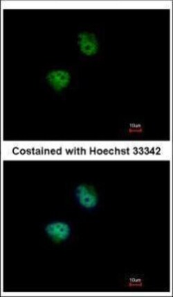 Invitrogen RPS6KB2 Polyclonal Antibody 100 &mu;L; Unconjugated:Antibodies,