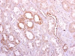 Invitrogen Ribophorin I Polyclonal Antibody 100 &mu;L; Unconjugated:Antibodies,