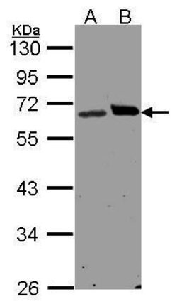 Invitrogen Ribophorin I Polyclonal Antibody 100 &mu;L; Unconjugated:Antibodies,