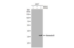 Invitrogen Annexin A2 Polyclonal Antibody 100 &mu;L; Unconjugated:Antibodies,