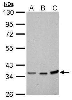 Invitrogen Annexin A2 Polyclonal Antibody 100 &mu;L; Unconjugated:Antibodies,