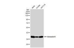 Invitrogen Annexin A2 Polyclonal Antibody 100 &mu;L; Unconjugated:Antibodies,