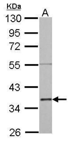 Invitrogen Annexin A2 Polyclonal Antibody 100 &mu;L; Unconjugated:Antibodies,