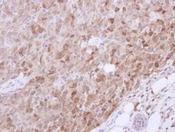 Invitrogen VGAT Polyclonal Antibody 100 &mu;L; Unconjugated:Anticorps,