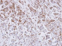 EXTL3 Polyclonal Antibody:Antibodies, Polyclonal