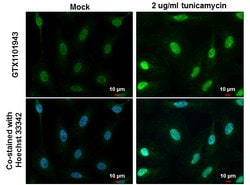 Invitrogen ATF4 Polyclonal Antibody 100 &mu;L; Unconjugated:Anticorps,