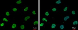 Invitrogen DNAJB6 Polyclonal Antibody 100 &mu;L; Unconjugated:Antibodies,