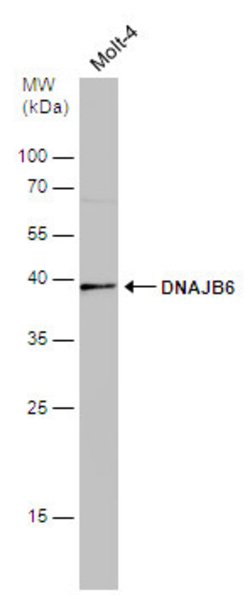 Invitrogen DNAJB6 Polyclonal Antibody 100 &mu;L; Unconjugated:Antibodies,