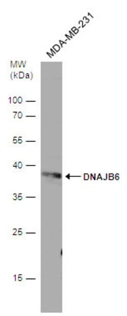 Invitrogen DNAJB6 Polyclonal Antibody 100 &mu;L; Unconjugated:Antibodies,