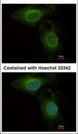 Invitrogen PHGDH Polyclonal Antibody 100 &mu;L | Buy Online | Invitrogen&trade; | Fisher Scientific