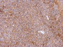 Invitrogen PHGDH Polyclonal Antibody 100 &mu;L; Unconjugated:Antibodies,