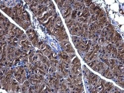Invitrogen PHGDH Polyclonal Antibody 100 &mu;L; Unconjugated:Antibodies,