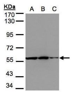 Invitrogen PHGDH Polyclonal Antibody 100 &mu;L; Unconjugated:Antibodies,