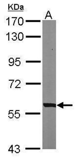 Invitrogen PHGDH Polyclonal Antibody 100 &mu;L; Unconjugated:Antibodies,