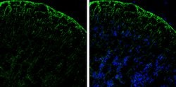 Invitrogen PHGDH Polyclonal Antibody 100 &mu;L; Unconjugated:Antibodies,