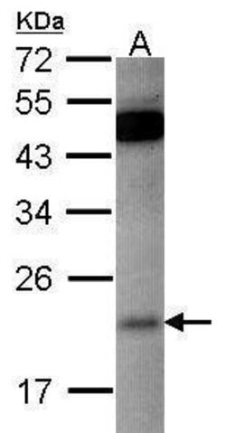 Invitrogen RAP1B Polyclonal Antibody 100 &mu;L; Unconjugated:Antibodies,