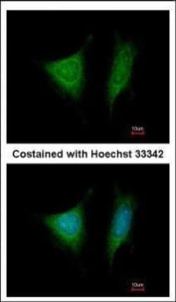 Invitrogen eIF3i Polyclonal Antibody 100 &mu;L | Buy Online | Invitrogen&trade; | Fisher Scientific