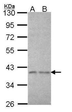 Invitrogen eIF3i Polyclonal Antibody 100 &mu;L | Buy Online | Invitrogen&trade; | Fisher Scientific