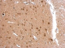 Invitrogen APLP2 Polyclonal Antibody 100 &mu;L; Unconjugated:Antibodies,