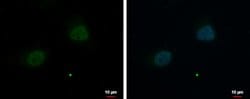 Invitrogen ZNF384 Polyclonal Antibody 100 &mu;L; Unconjugated:Antibodies,
