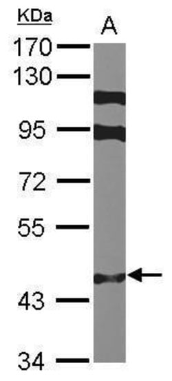 Invitrogen ZNF384 Polyclonal Antibody 100 &mu;L; Unconjugated:Antibodies,