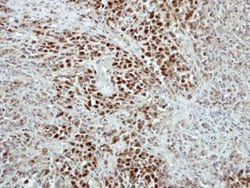 RAP1 Polyclonal Antibody:Antibodies, Polyclonal