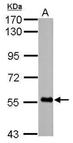 Invitrogen FBXO7 Polyclonal Antibody 100 &mu;L; Unconjugated:Antibodies,