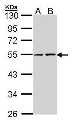 RUVBL2 Polyclonal Antibody, Invitrogen 100 &mu;L; Unconjugated:Antibodies,