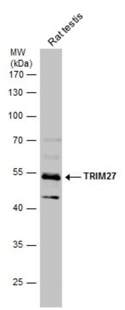 Invitrogen TRIM27 Polyclonal Antibody 100 &mu;L; Unconjugated:Antibodies,