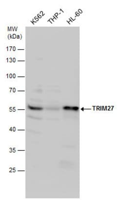 Invitrogen TRIM27 Polyclonal Antibody 100 &mu;L; Unconjugated:Antibodies,