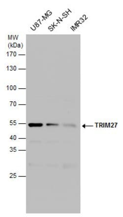 Invitrogen TRIM27 Polyclonal Antibody 100 &mu;L; Unconjugated:Antibodies,