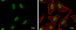 Invitrogen PUF60 Polyclonal Antibody 100 &mu;L; Unconjugated:Antibodies,