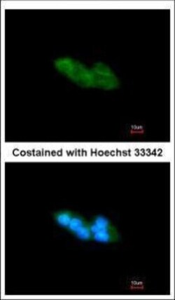 Invitrogen ARMET Polyclonal Antibody 100 &mu;L | Buy Online | Invitrogen&trade; | Fisher Scientific
